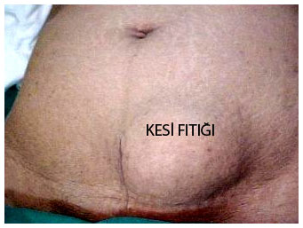 kesiyerifitigi